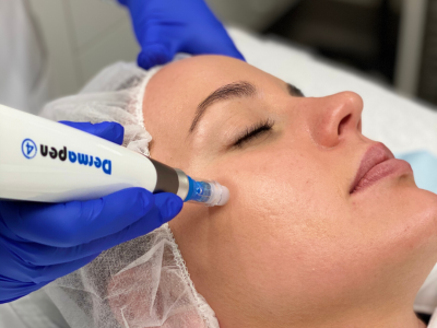 Medical Skin Needling